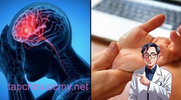 Theo các chuyên gia, nguy cơ đột quỵ tăng cao ở những người có bệnh lý tim mạch, rối loạn chuyển hóa hoặc lối sống thiếu lành mạnh. 