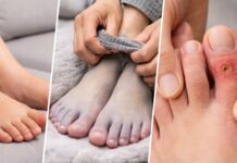 3 dấu hiệu ở chân có thể đang cảnh báo bệnh nguy hiểm, nhiều người thường bỏ qua