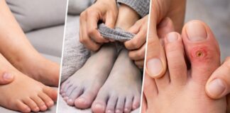 3 dấu hiệu ở chân có thể đang cảnh báo bệnh ng:uy h:iểm, nhiều người thường bỏ qua