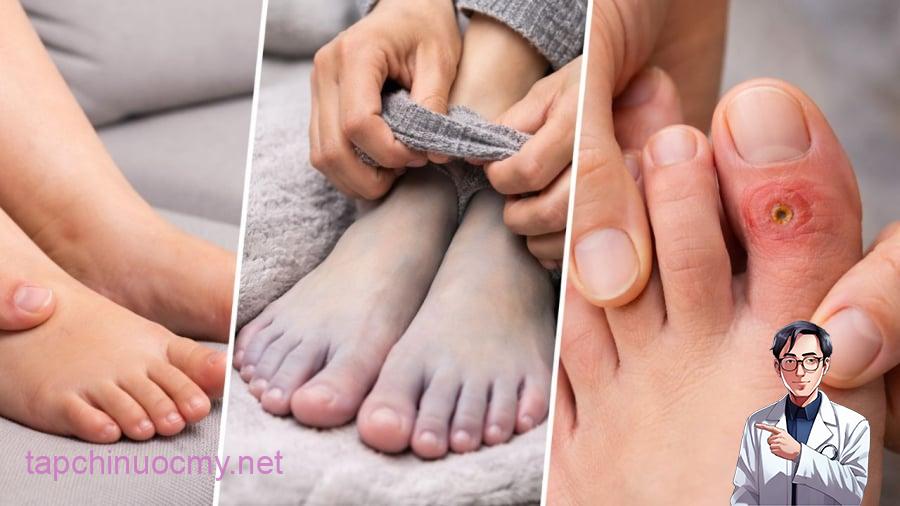 Khi chân cùng lúc xuất hiện các dấu hiệu này thì các bạn lưu ý