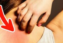 Ung thư ƌừng ƌể quá muộn: Bác sĩ Bệnh viện Việt Đức cảnh Ьáo 6 dấu hiệu không thể Ьỏ quɑ