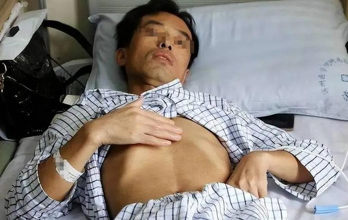 Người ᵭàn ȏng 53 tuổi mắc ᴜng thư gan, bác sĩ tức giận: Đừng ʟàm việc này quá 3 ʟần 1 tháng- Ảnh 1.