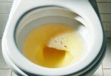 Đi tiểu thấy nhiều bọt có phải bị suy thận?