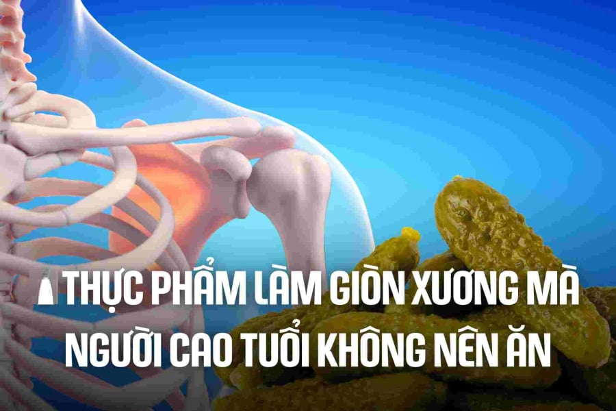 3 ʟoại nước ʟà 'vua rút cạn canxi, ᴜṓng nhiḕu xương giòn, dễ gãy