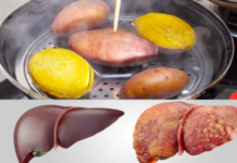 Ăn khoai lang hấp mỗi ngày, người phụ nữ hoảng hốt khi nhận kết quả khám gan: Sao lại như vậy được