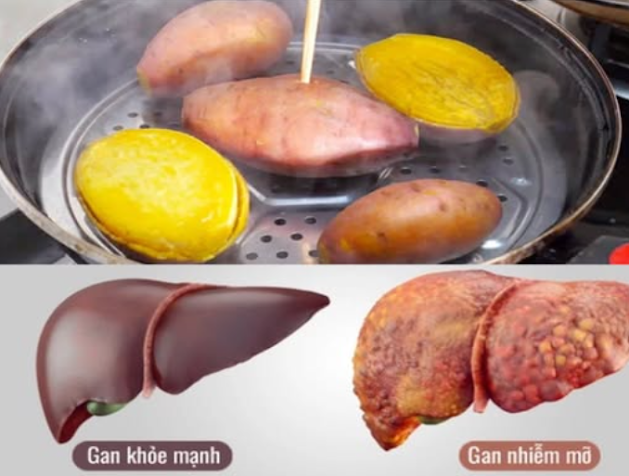 Ăn khoai lang hấp mỗi ngày, người phụ nữ hoảng hốt khi nhận kết quả khám gan: Sao lại như vậy được