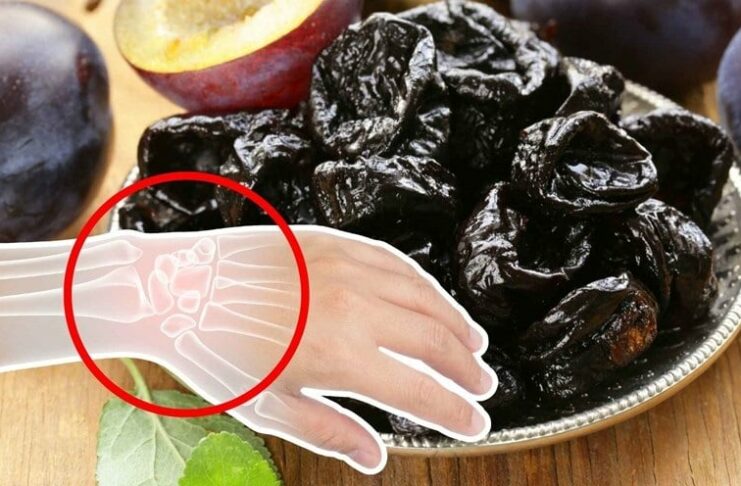 Có 3 loại nước là ‘vua rút cạn canxi, uống càng nhiều xương càng giòn, dễ gãy nhưng nhiều người Việt dùng hàng ngày
