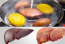 Ăn khoai lang hấp mỗi ngày, người phụ nữ hoảng hốt khi nhận kết quả khám gan: Sao lại như vậy được