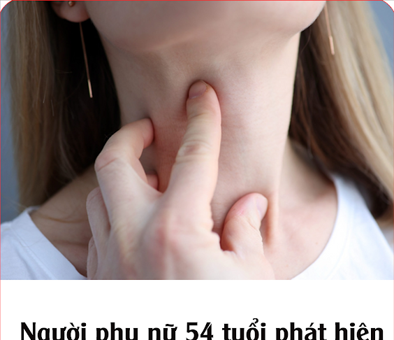 Người phụ nữ 54 tuổi phát hiện ung thư tuyến giáp từ dấu hiệu nhiều người bỏ qua