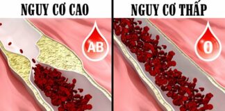 Nếu bạn có nhóm máu O, nhất định phải biết những điều này để giữ mạng sống